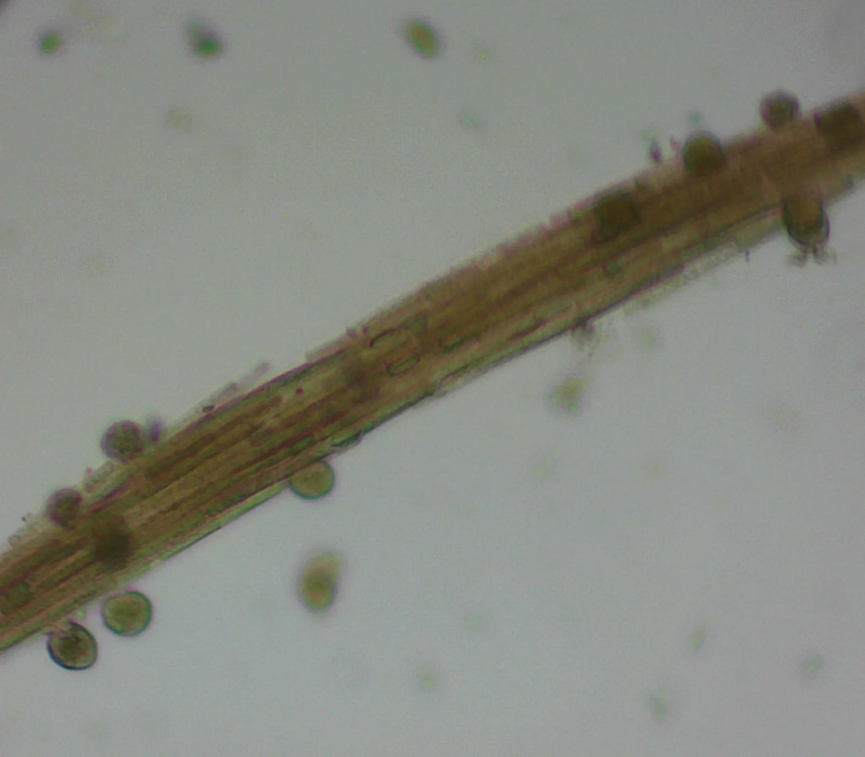 Aphanizomenon
