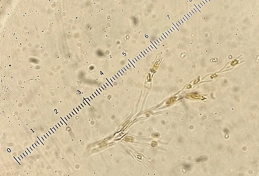 Dinobryon (with scale)