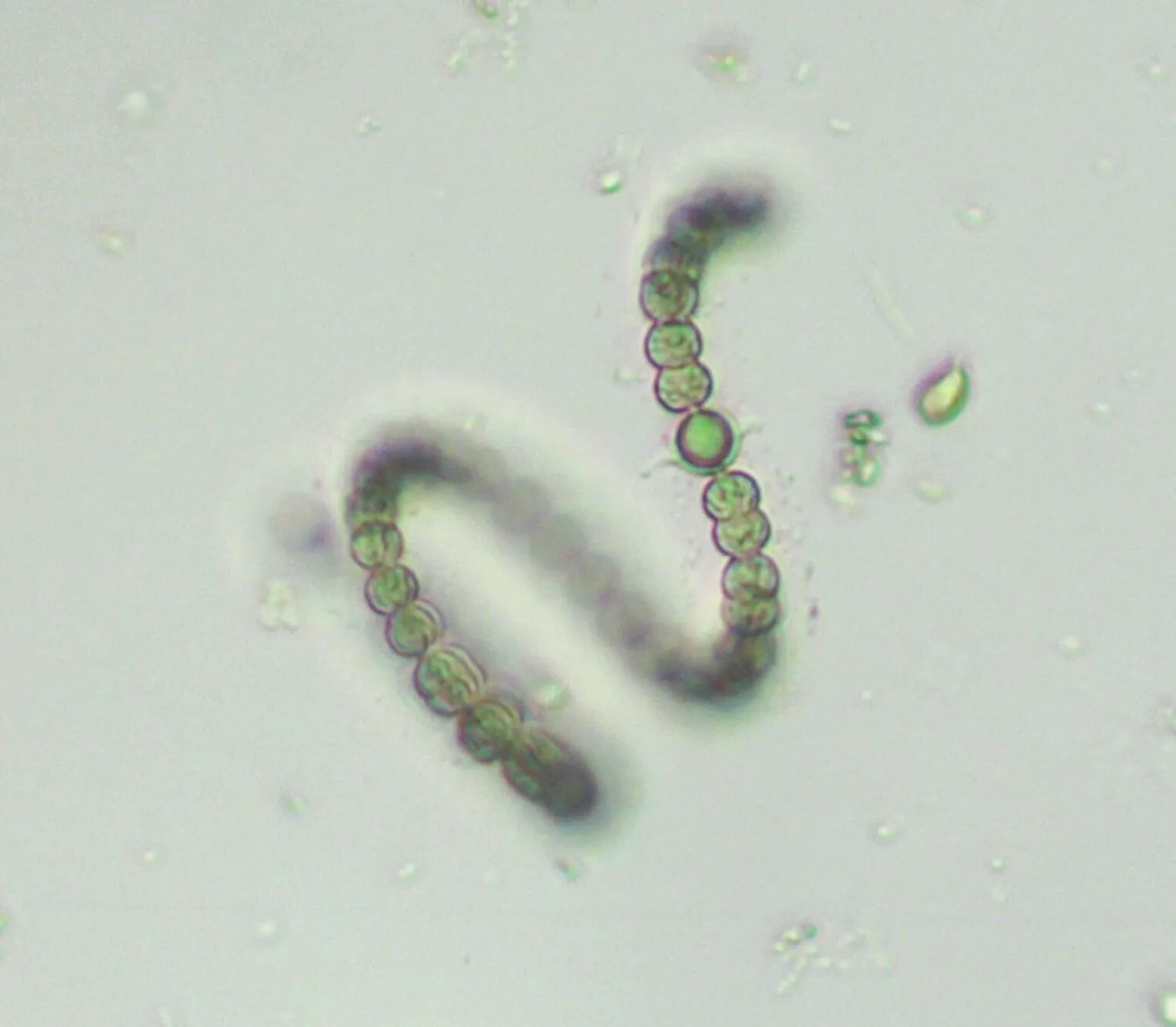 Dolichospermum
