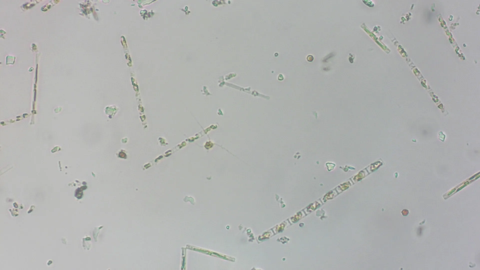 Skeletonema